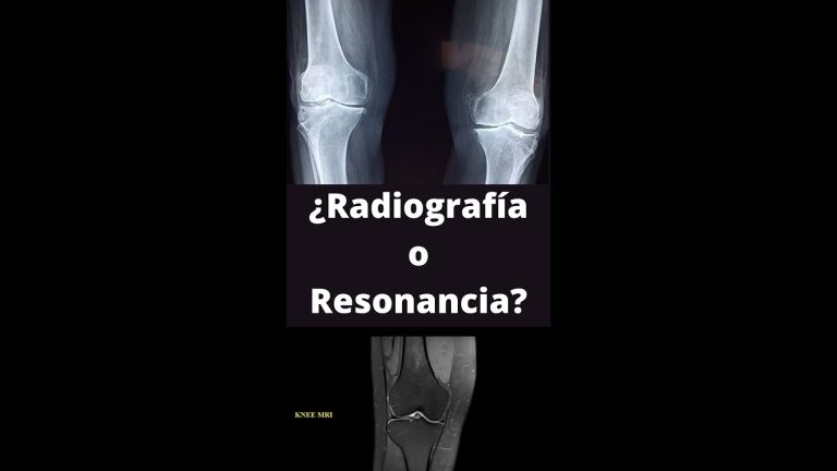 Resonancia magnética vs. Rayos X: ¿Cuál es la diferencia?