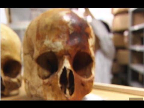 Descubre cómo identificar si un esqueleto es hombre o mujer de forma precisa
